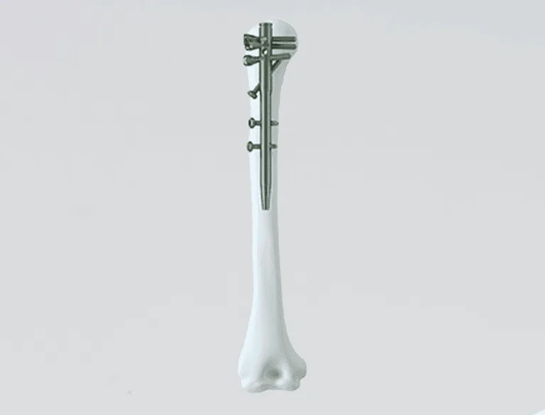 MULTILOCK HUMERAL NAIL